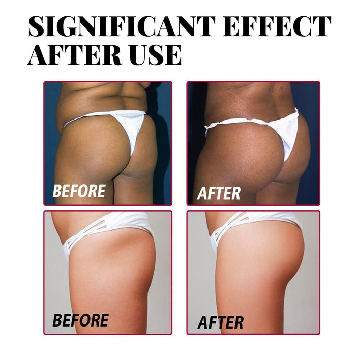 Plump Buttock Cream Lifts And Tightens Buttocks - Magellan Fashion Shop