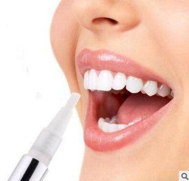 Teeth Whitening Pen - Magellan Fashion Shop
