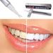 Teeth Whitening Pen - Magellan Fashion Shop