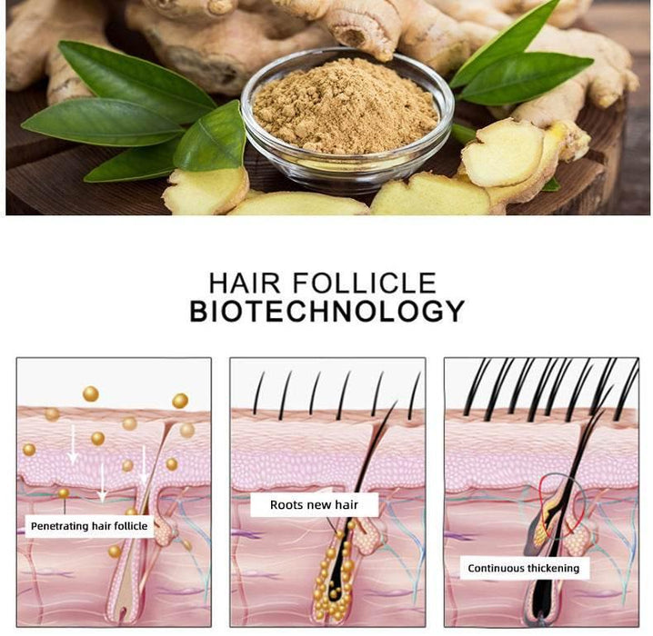 Hair Growth Oil Hair Growth Oil Oem Hair Care Essential Oil - Magellan Fashion Shop