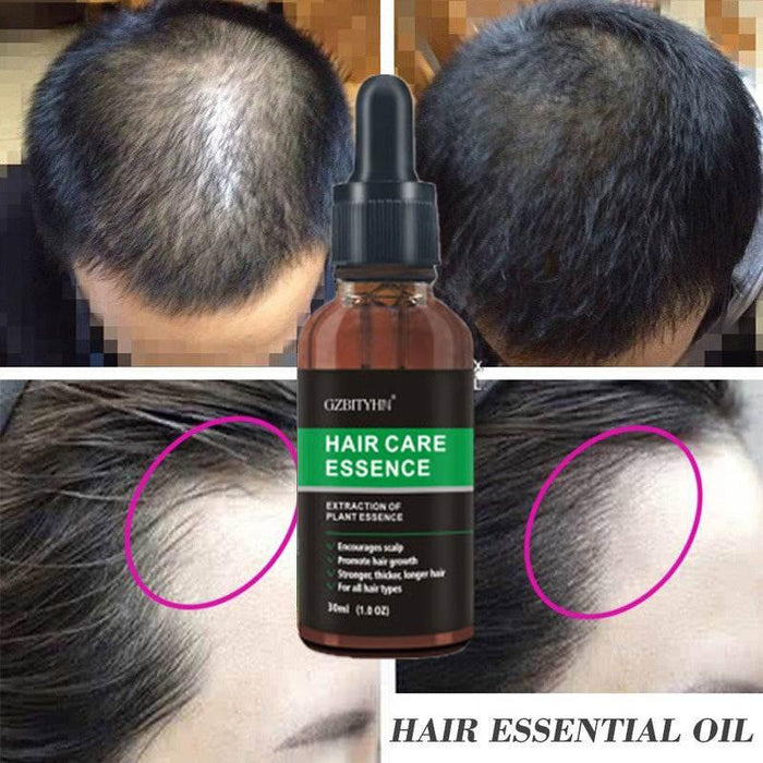 Hair Growth Oil Hair Growth Oil Oem Hair Care Essential Oil - Magellan Fashion Shop