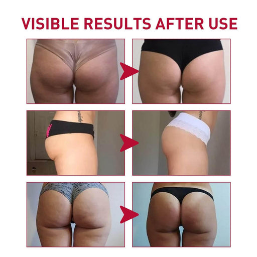 Plump Buttock Cream Lifts And Tightens Buttocks - Magellan Fashion Shop