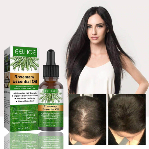 Rosemary Anti-Breakage Nourishing Hair Care Oil - Magellan Fashion Shop