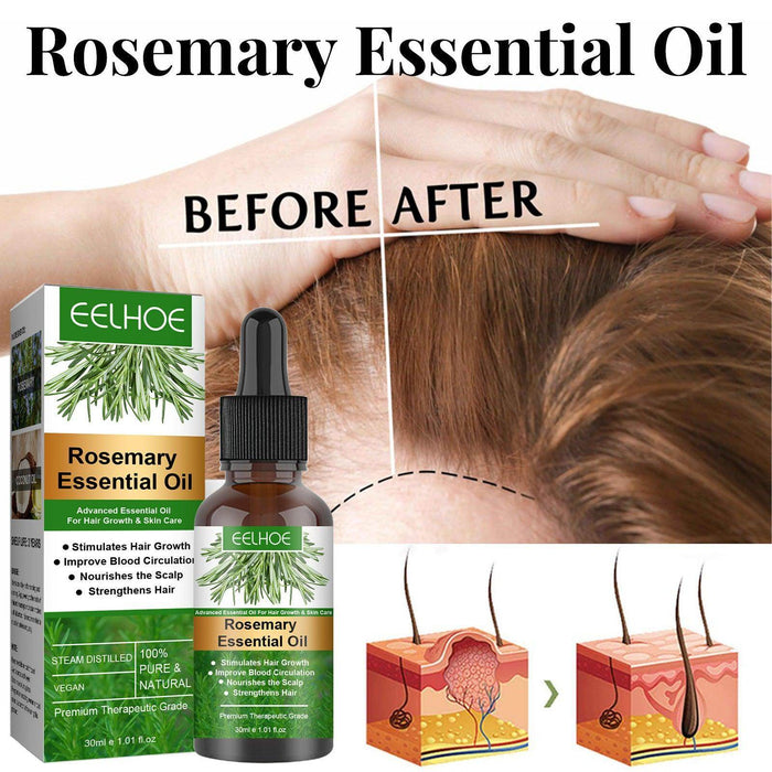 Rosemary Anti-Breakage Nourishing Hair Care Oil - Magellan Fashion Shop