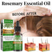 Rosemary Anti-Breakage Nourishing Hair Care Oil - Magellan Fashion Shop